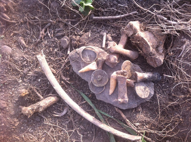 Human-Remains-rings-and-buttons