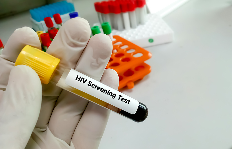 Province of Manitoba says HIV rates increasing, especially in women